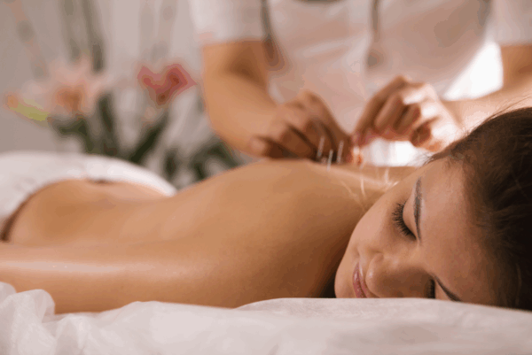 needling therapies